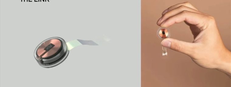 Первый человек, который играет в CS2 силой мысли c чипом от Илона Маска