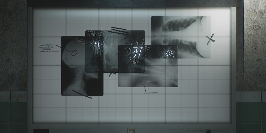 silent hill 2 remake x-ray puzzle