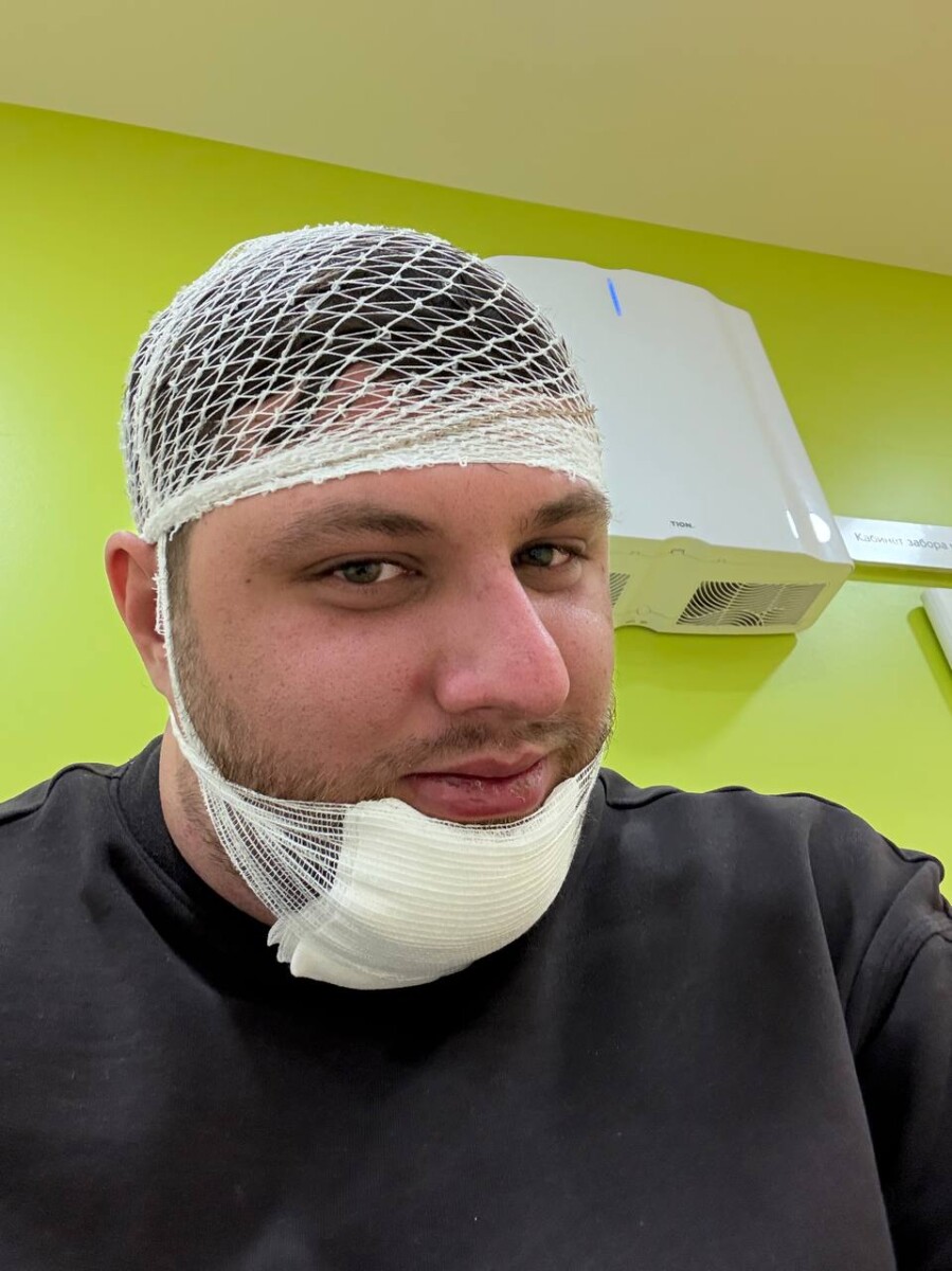 SQreen после ДТП